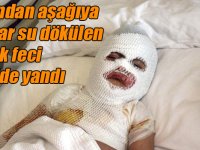 Başından aşağıya kaynar su dökülen çocuk feci şekilde yandı