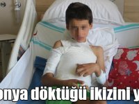 Sosyal medyadan görüp üzerine kolonya döktüğü ikizini yaktı