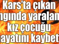 Kars’ta çıkan yangında yaralanan kız çocuğu hayatını kaybetti