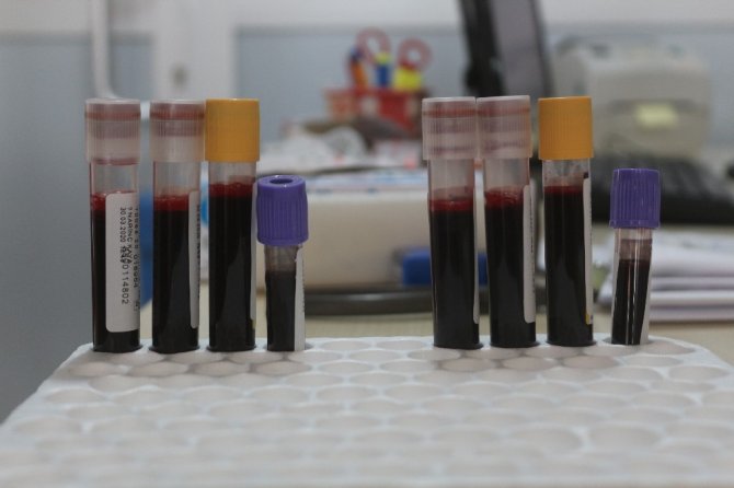 Korona virüs kan bağışlarını yüzde 75 düşürdü