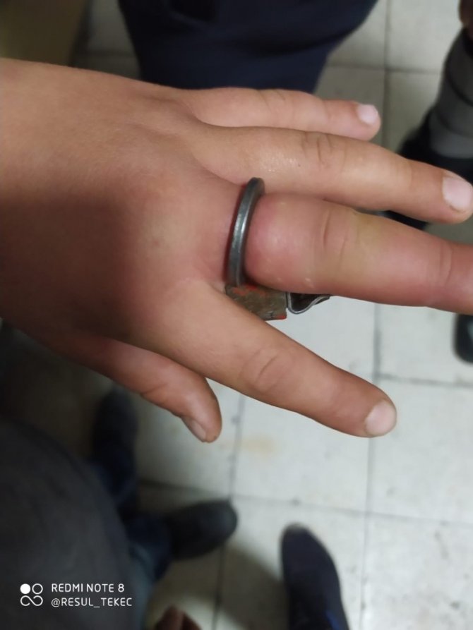 10 yaşındaki çocuğun parmağı pencere kilit aparatına sıkıştı