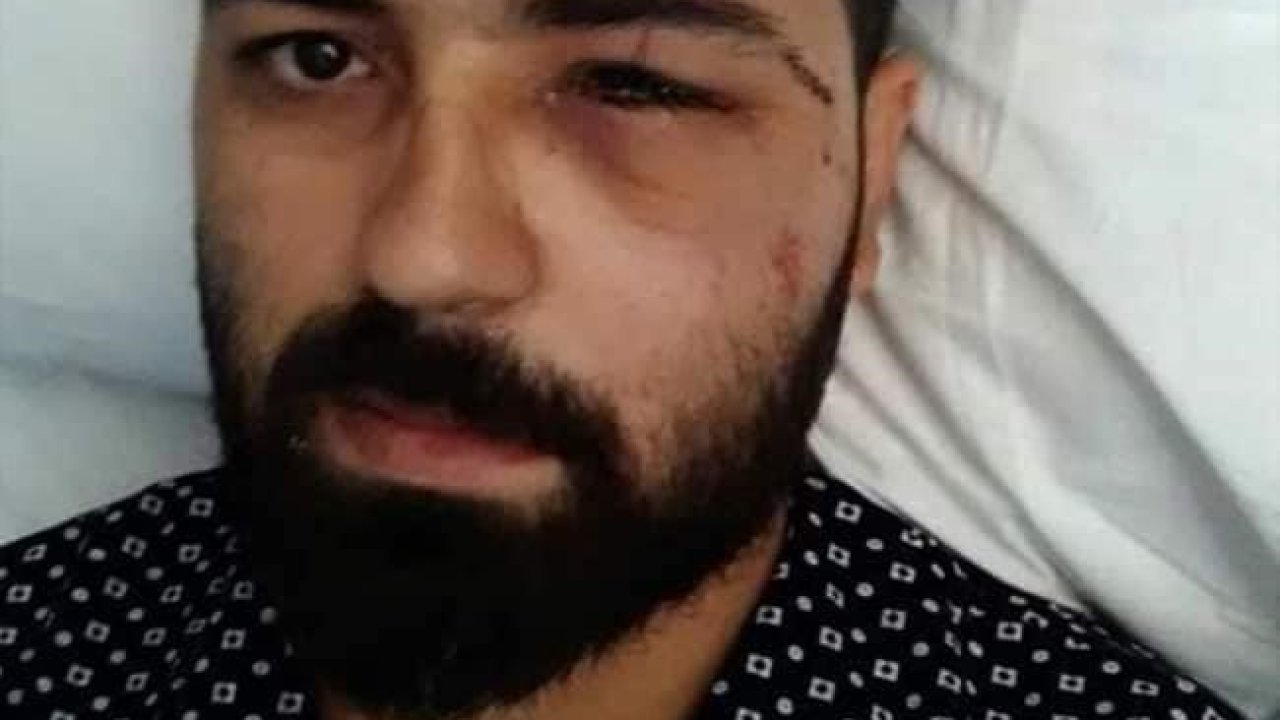 15 Temmuz Gazisi Akkoç: "Darbeci asker dalga geçer bir ses tonu ile ‘sen kelime-i şehadet getir’ dedi"