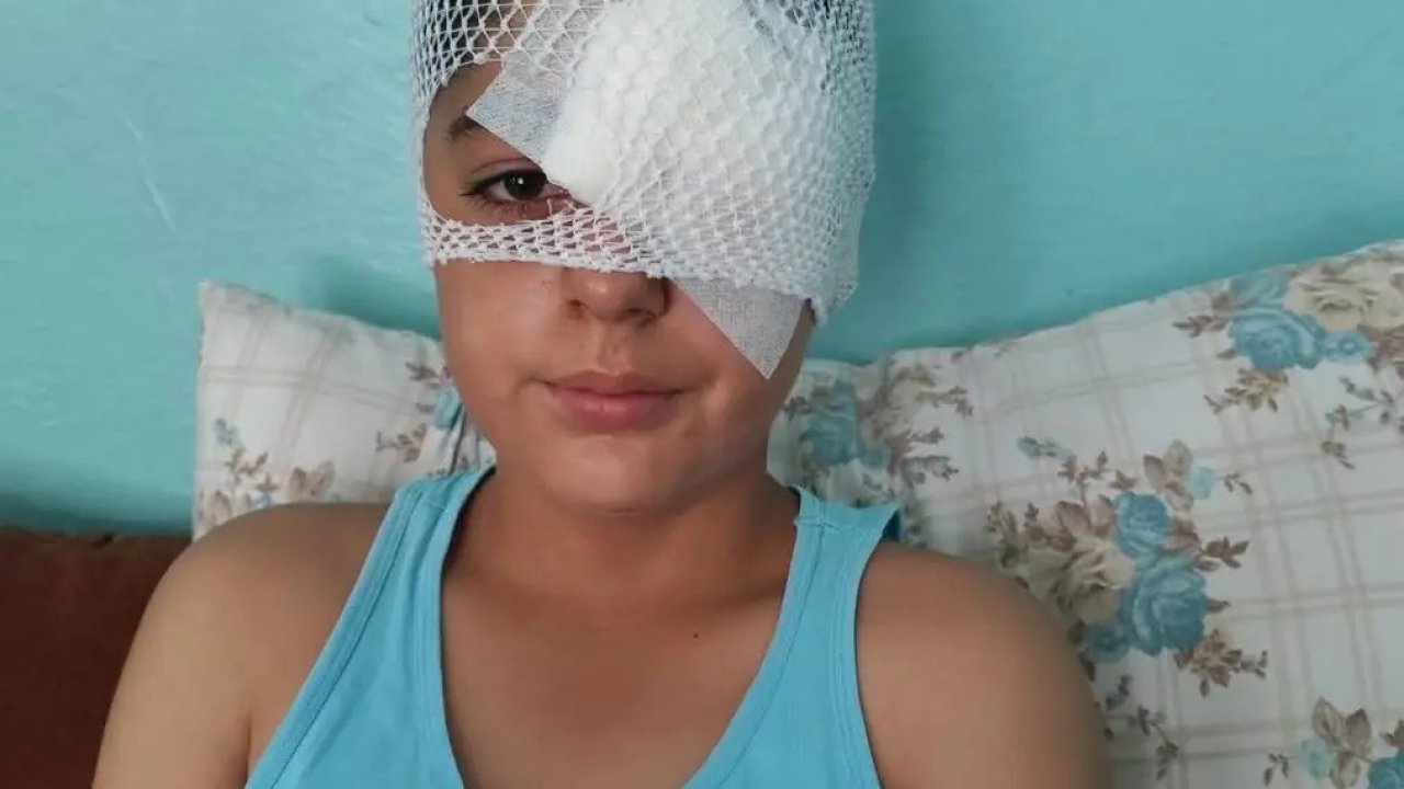 Şanlıurfa’da köpek saldırısından kaçan çocuğa otomobil çarptı