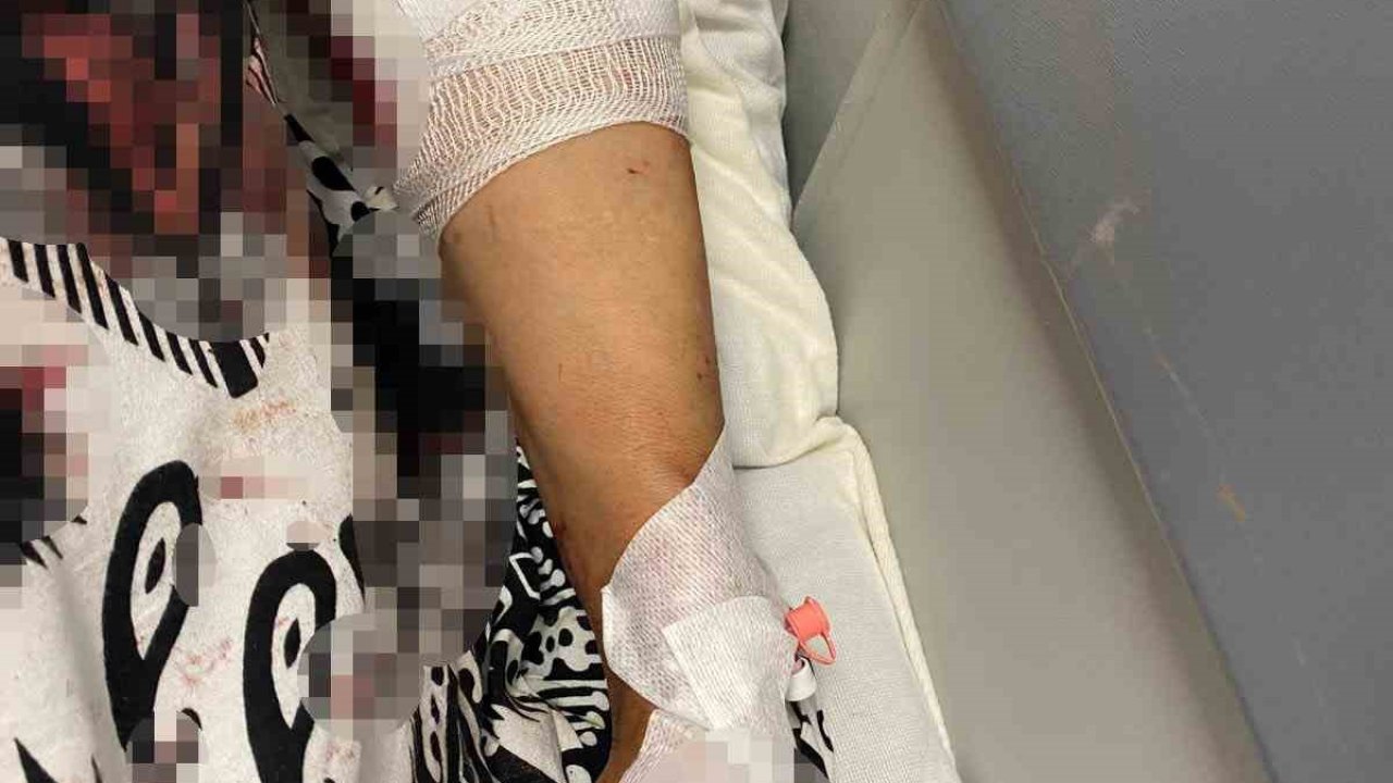 Abdest almak için bahçeye çıkan kadına köpekler saldırdı