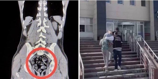 Kars’ta Uluslararası Uyuşturucu Operasyonu