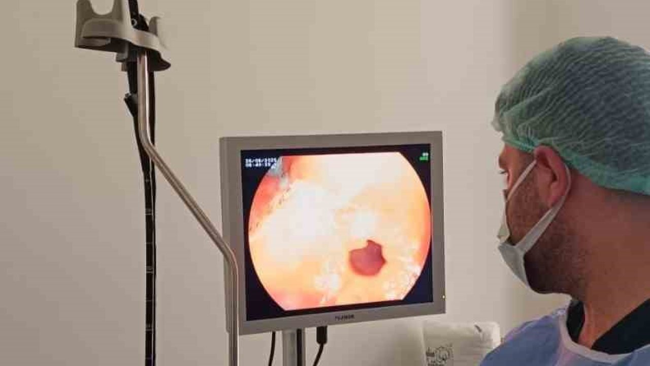 Çermik Devlet Hastanesinde endoskopi ve kolonoskopi ünitesi hizmet vermeye başladı