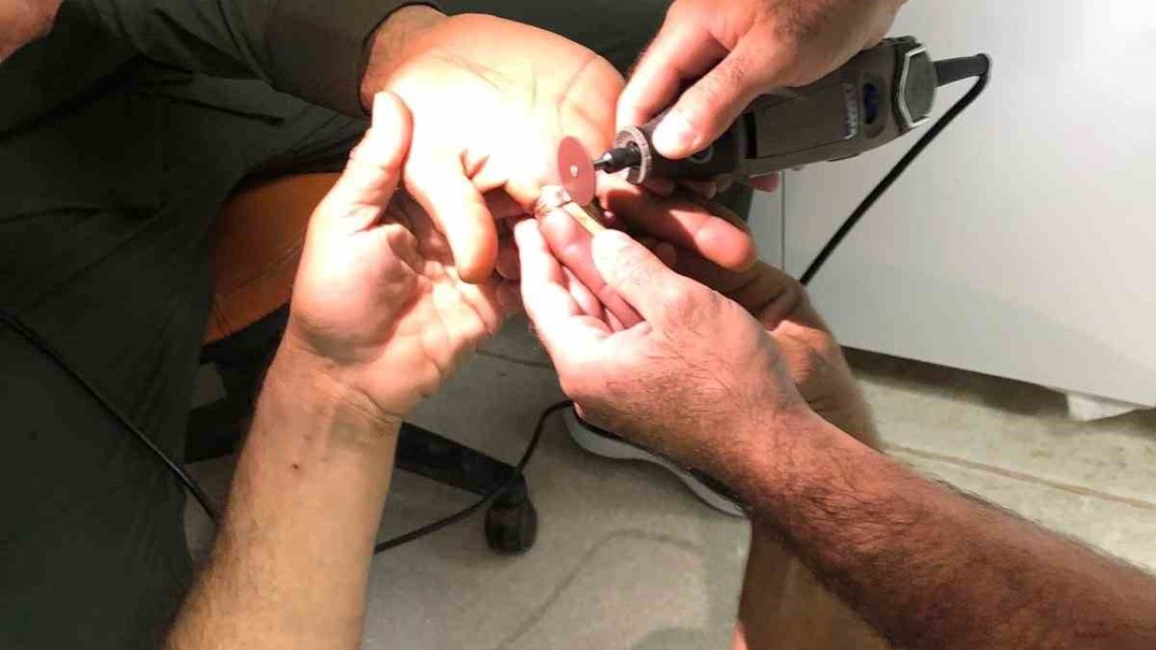 Mardin’de bir kişinin parmağında sıkışan yüzük itfaiye ekiplerince çıkartıldı