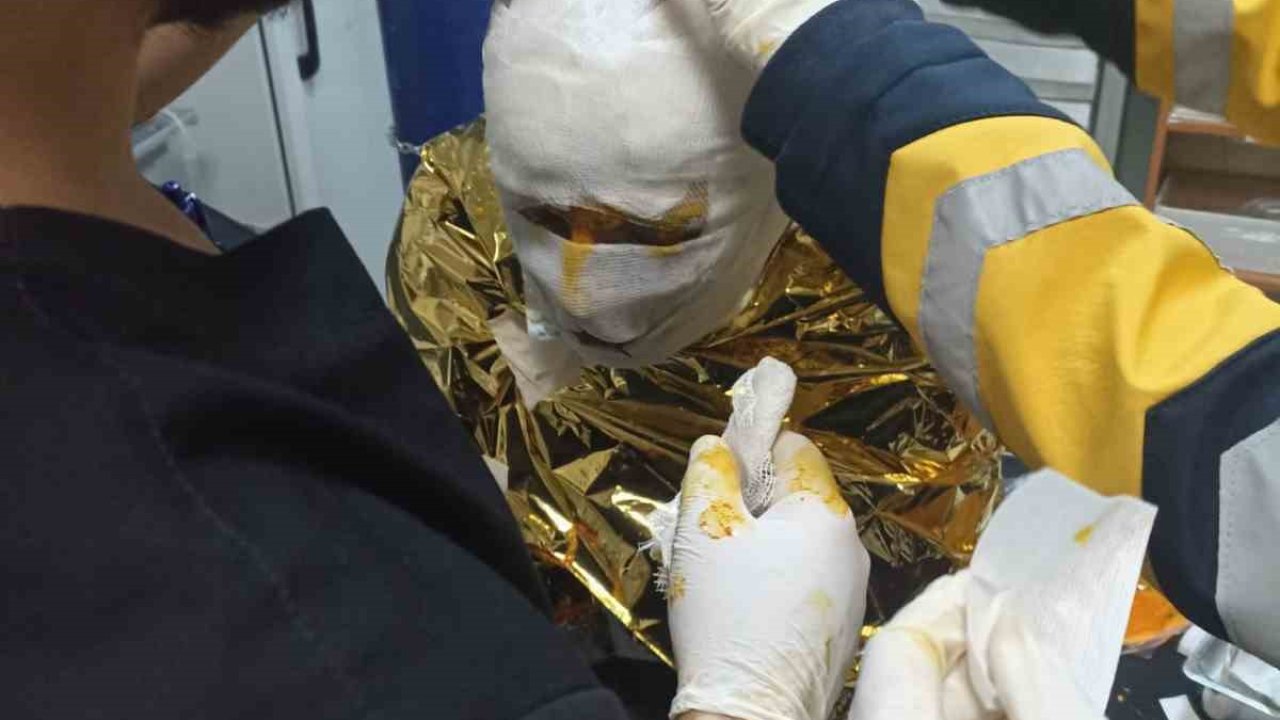 Erzincan’da kömür ocağında yangın: 2 işçi yaralı