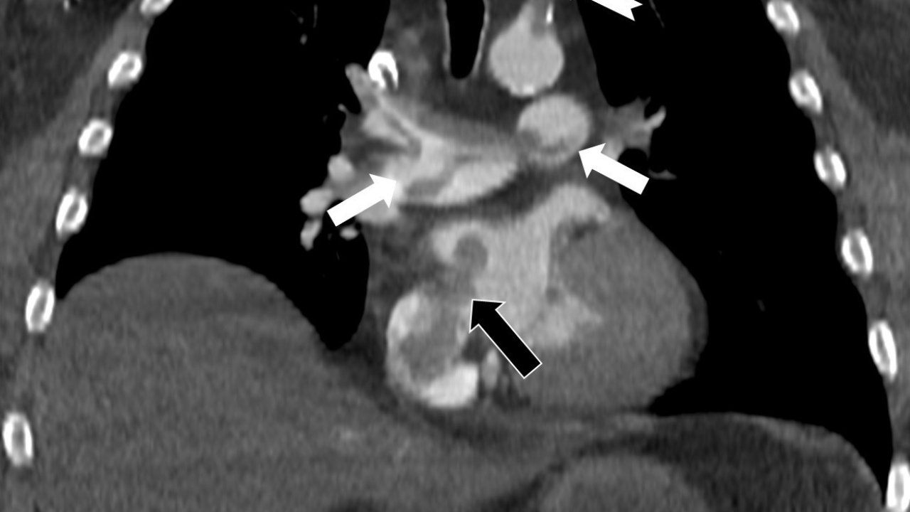 Tekden’de başarılı çalışmalara imza atan radyoloji uzmanından hayati tespit