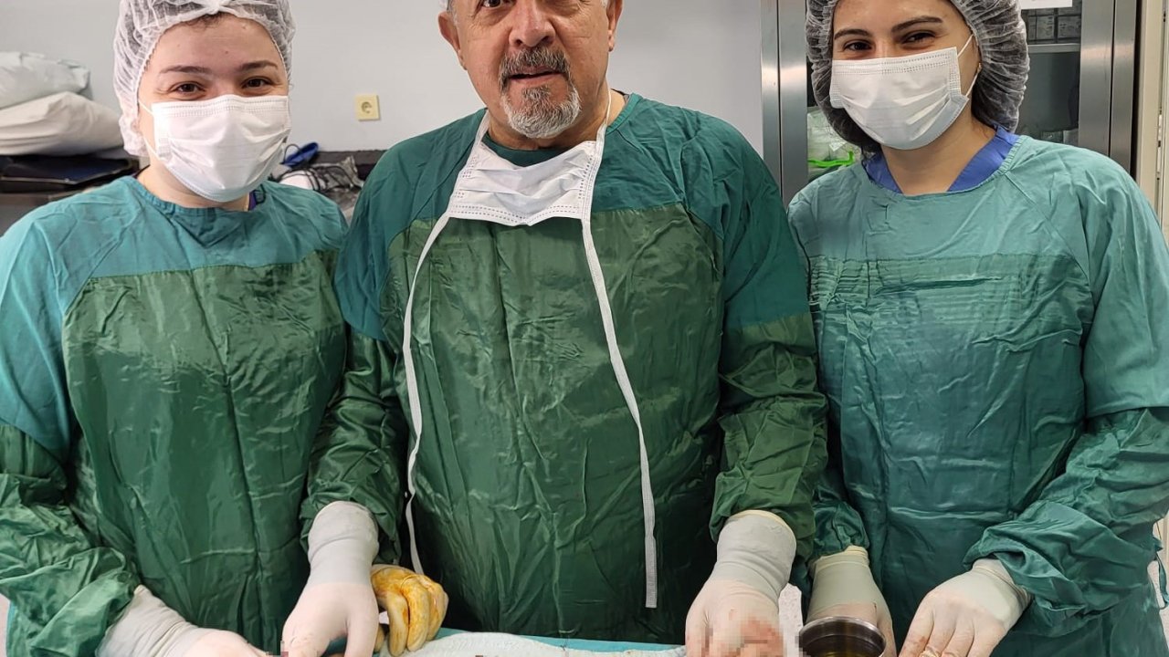 Karın ağrısıyla gitti, safrasından binlerce taş çıktı