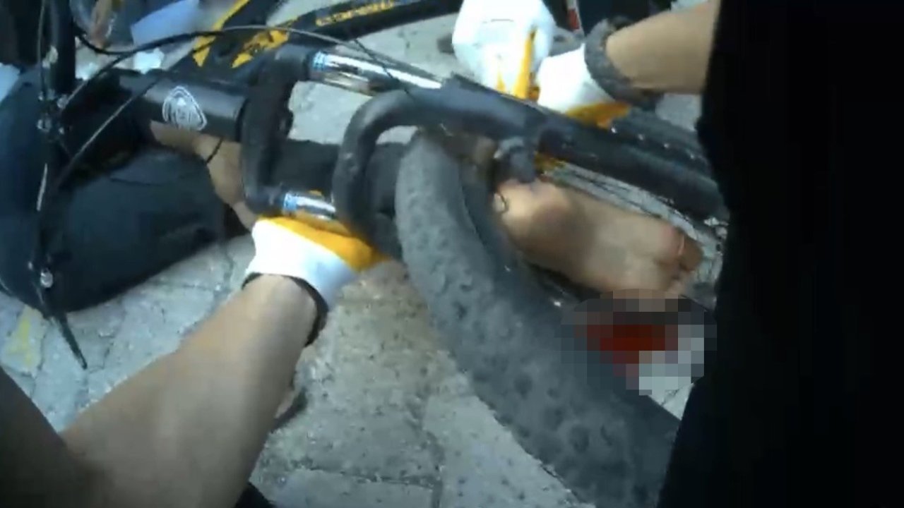 Osmaniye’de ayağı bisikletin tekerine sıkışan çocuk ekiplerce kurtarıldı