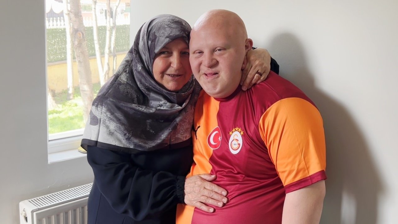 Down sendromlu annesinin sosyal alan ve anlayış isteği