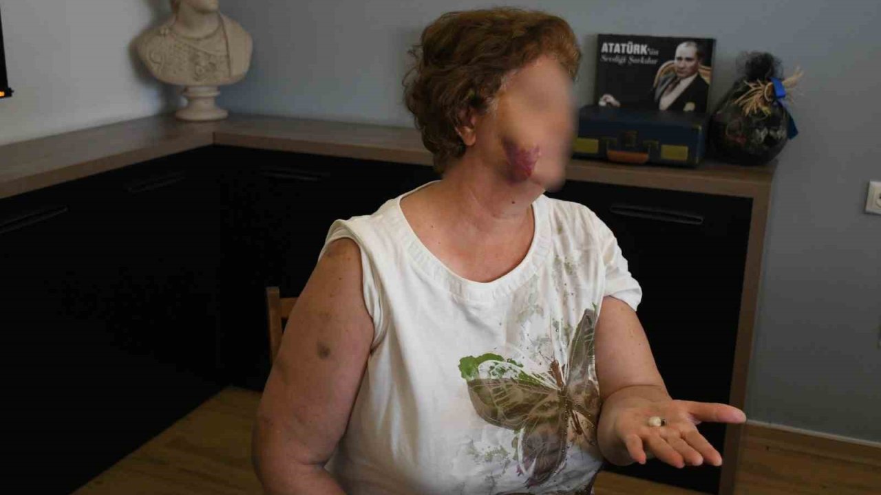 Kuşadası’nda ev kavgası kanlı bitti: Anne ve iki çocuğu bıçaklandı