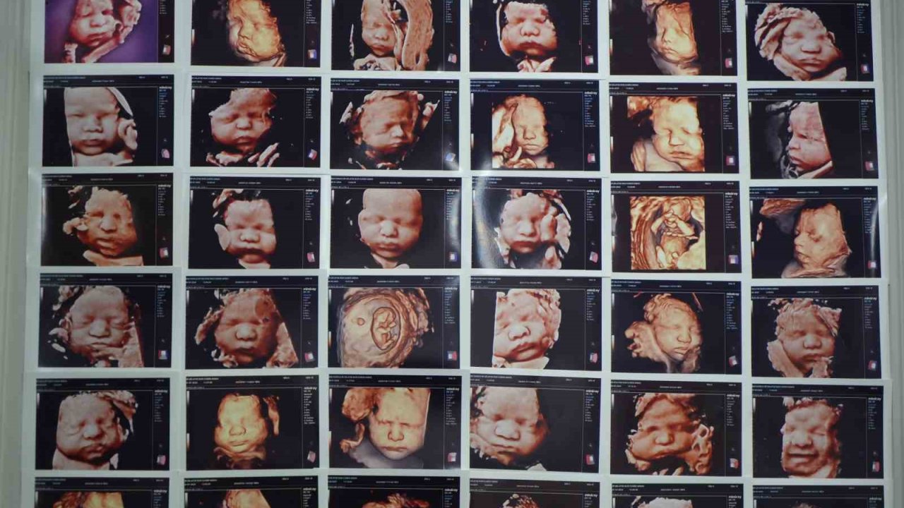 7 yıllık bebek hasreti "kişiye özel" tedaviyle son buldu