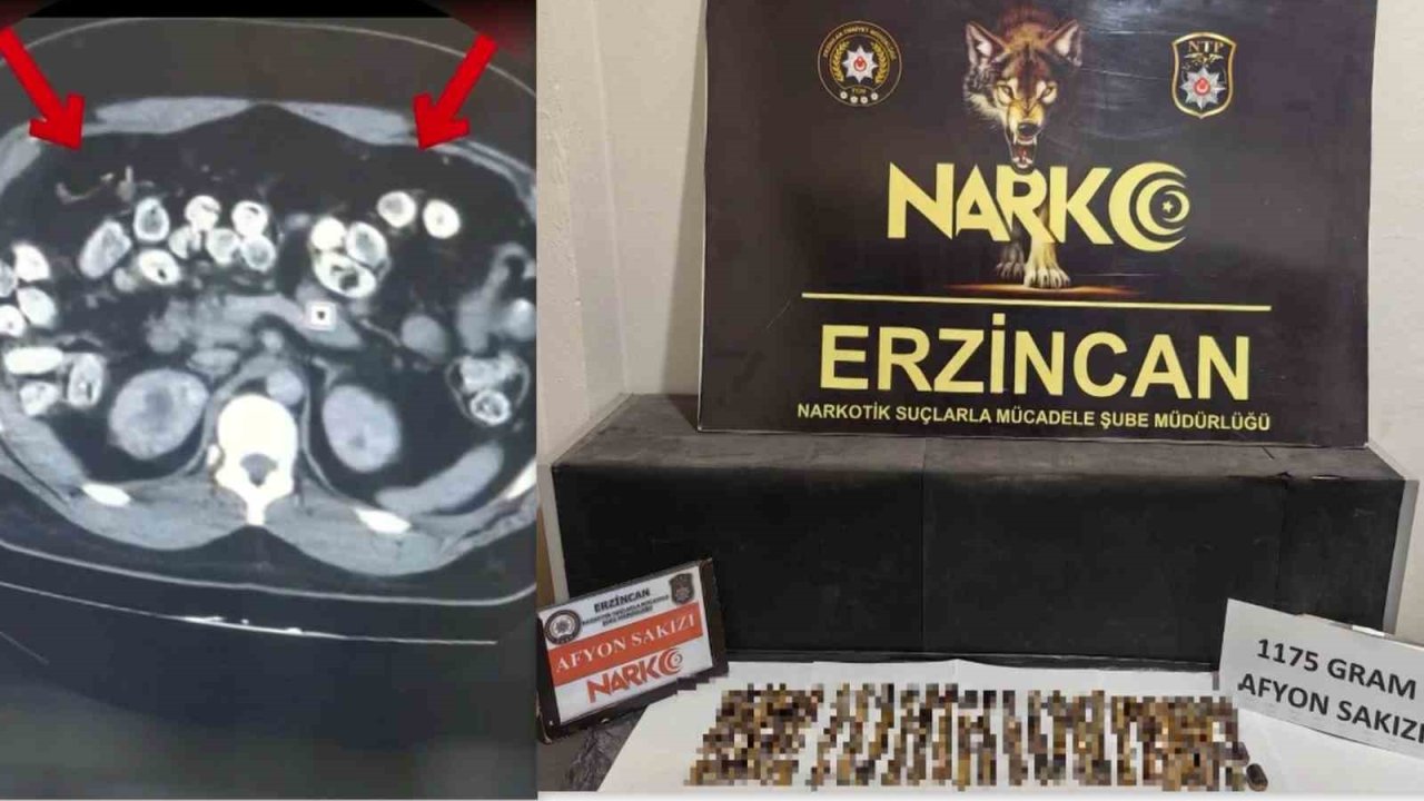 Erzincan’da uyuşturucuyu vücutlarında taşıyan 3 şüpheli yakalandı
