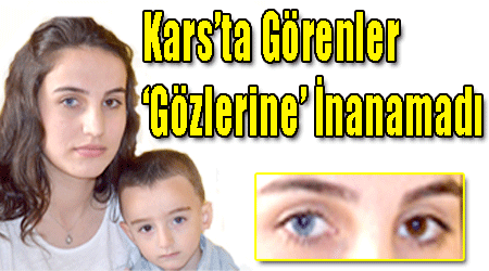 Kars'ta Görenler 'Gözlerine' İnanamadı!
