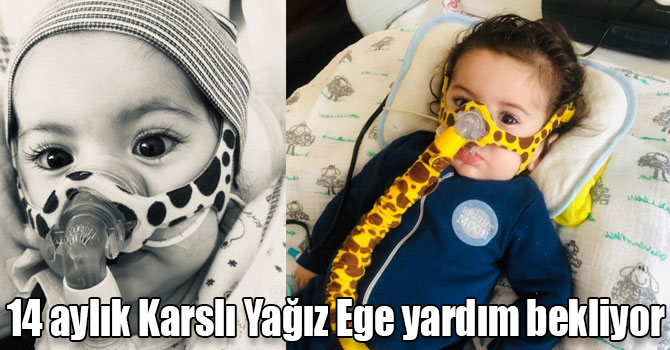 14 aylık Karslı Yağız Ege yardım bekliyor