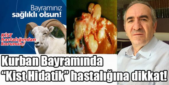 'Kist Hidatik' hastalığına dikkat!