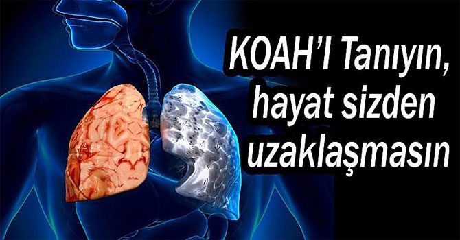 KOAH’ı tanıyın, hayat sizden uzaklaşmasın!