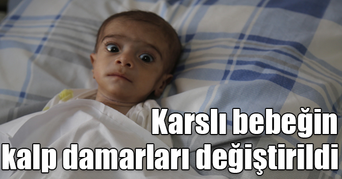Karslı 4 aylık bebeğin kalp damarları değiştirildi