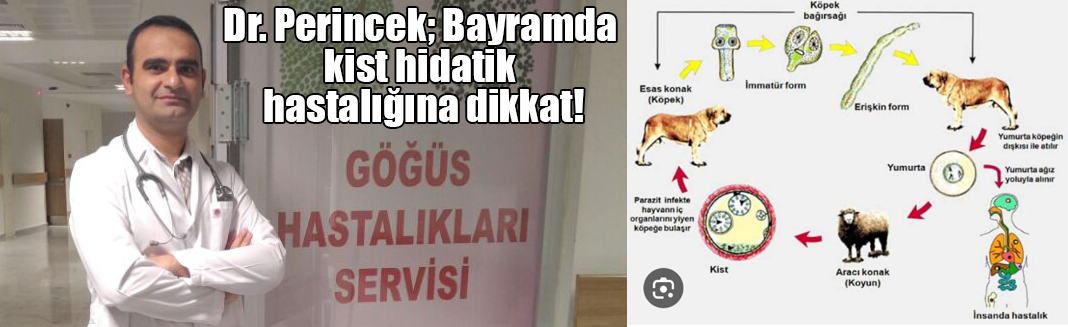 Dr. Perincek; Bayramda kist hidatik hastalığına dikkat!