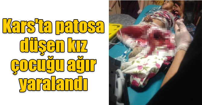 Kars'ta patos makinesine düşen kız çocuğu ağır yaralandı