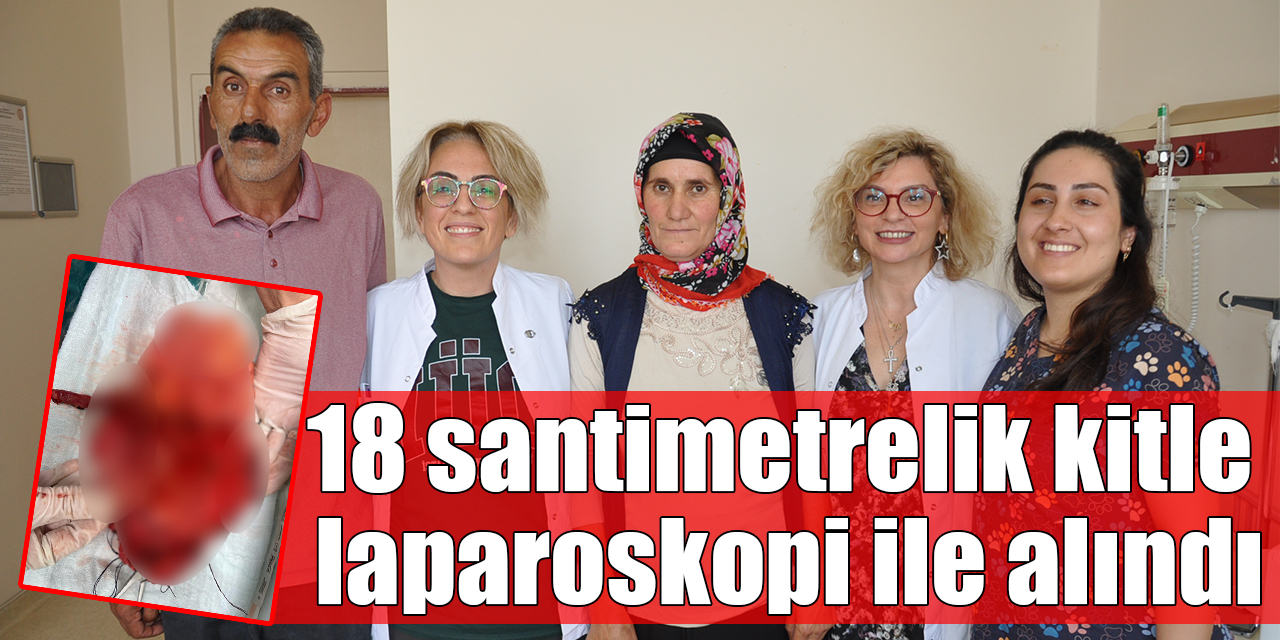 18 santimetrelik kitle laparoskopi ile alındı