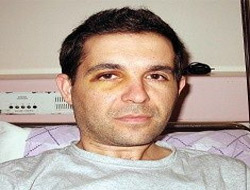 Kars'tan Ankara'ya Sevkedildi