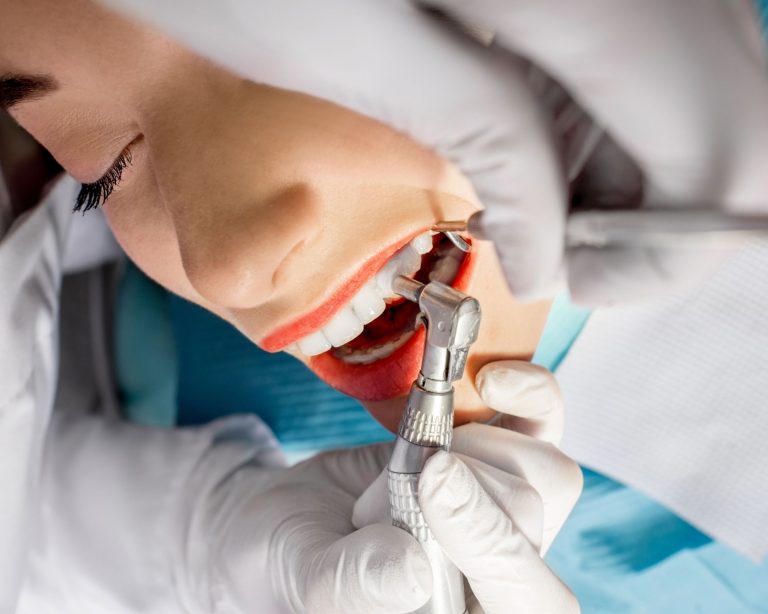 Diş Taşı Temizliği: Diş Sağlığınızı Korumanın Önemi