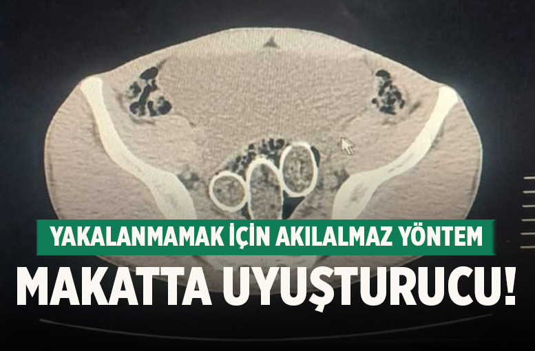 Kars'ta yine 2 Kişinin 'Makatından' uyuşturucu çıkarıldı!