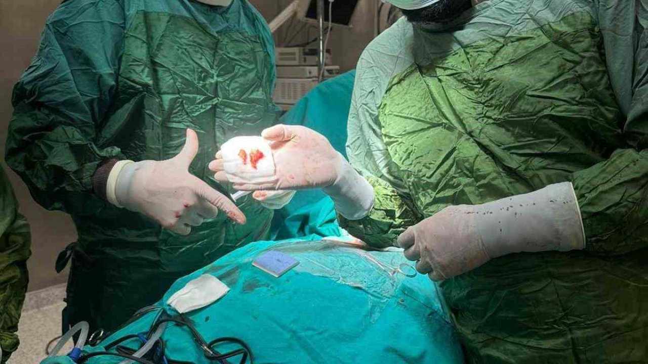 Burdur’da 71 yaşındaki hastanın şah damarındaki yüzde 99’luk tıkanıklık başarıyla açıldı