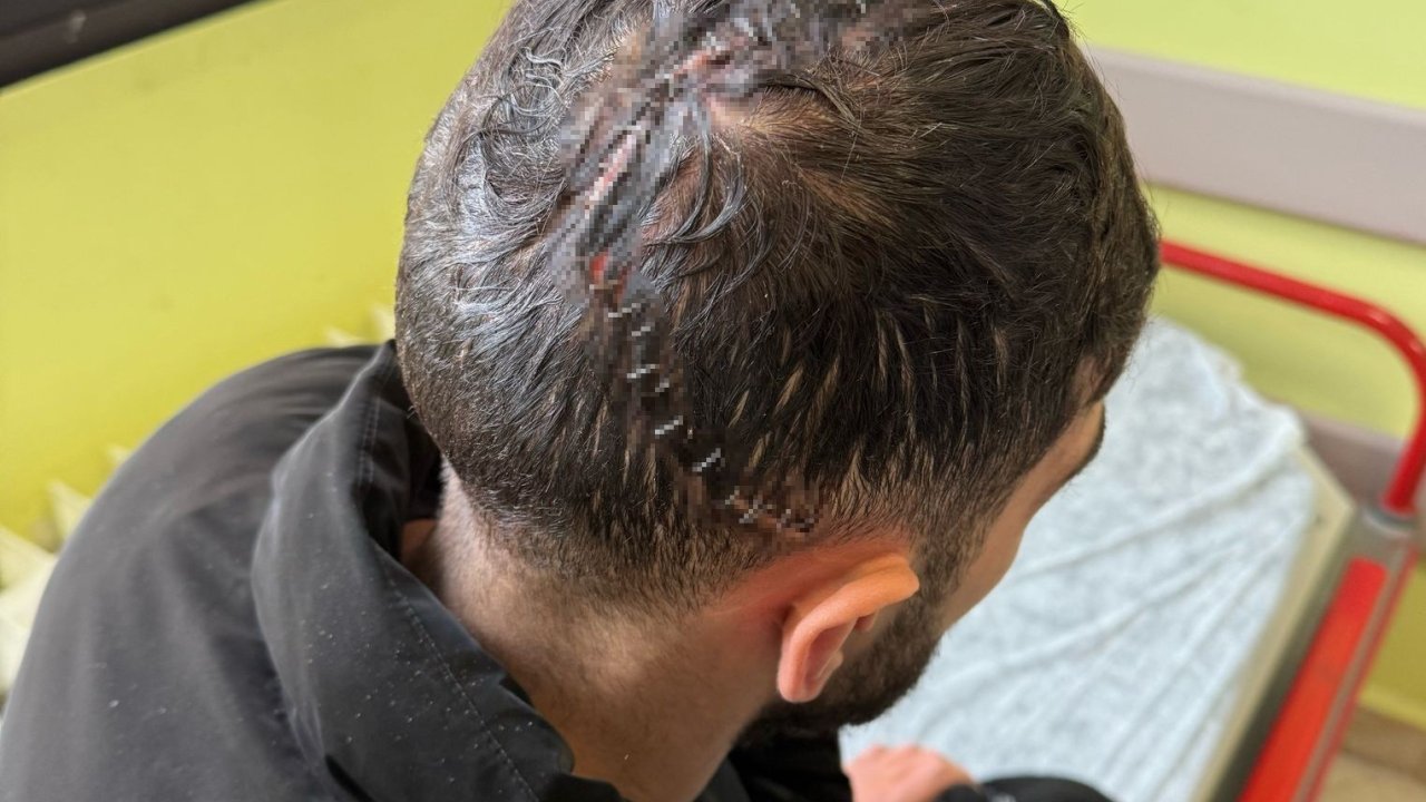 Edirne’de iş kazasında hafızasını kaybetti: Sadece annesini hatırlıyor