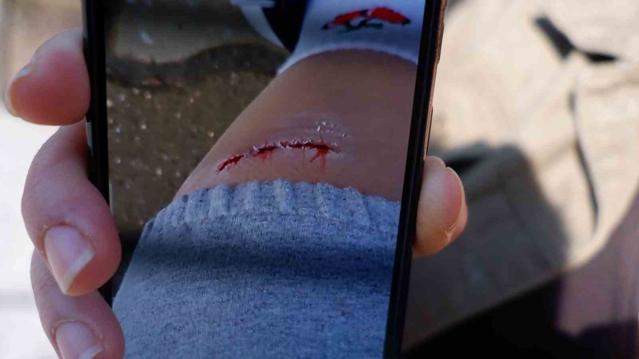 Edirne’de köpeğin ısırdığı kadın yaralandı