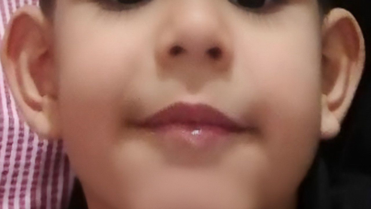 Motosikletin çarptığı minik Çınar, yaşam savaşını kaybetti