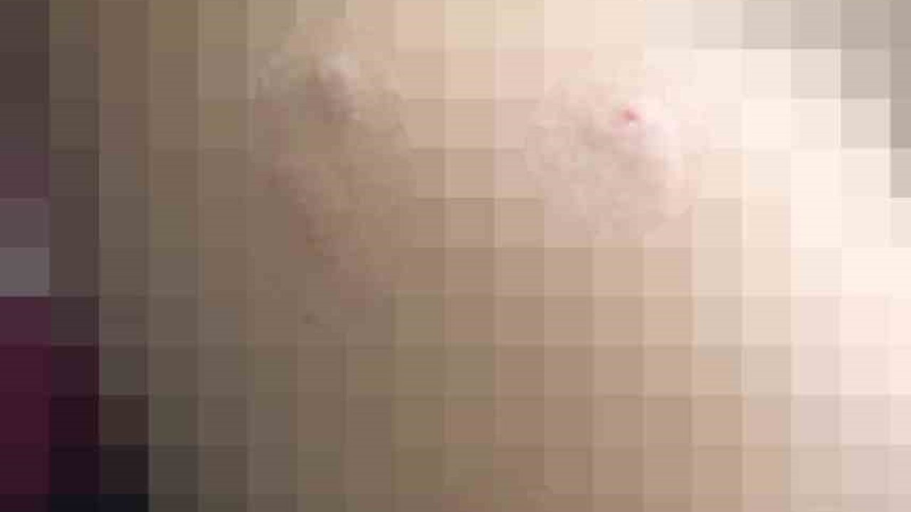 Sokak köpeği 5 yaşındaki çocuğa saldırdı