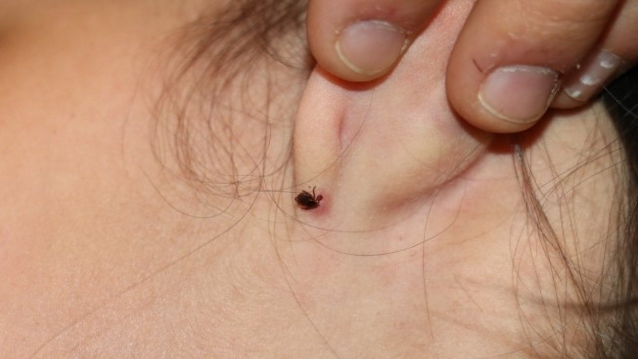 Havaların ısınmasıyla birlikte kenelerle temas riski arttı