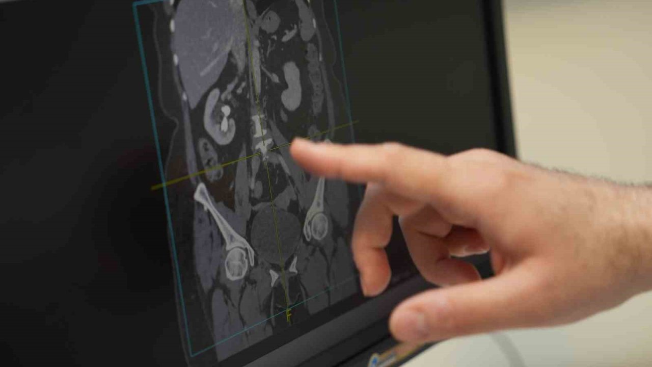 "Erkek sağlığının sırrı sofrada: Beslenmeyle cinsel gücü artırın"