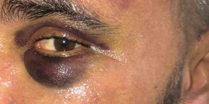 İsyeri sahibi dükkanında öldüresiye darp edildi