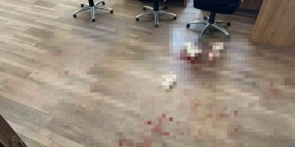 Yozgat’ta okul müdürünü darbeden saldırgan tutuklandı