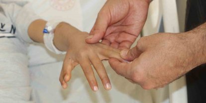 Şırnak’ta yapışık parmaklı iki kardeş ameliyatla sağlıklarına kavuştu