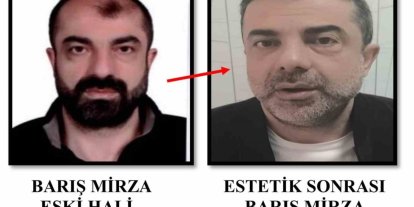 Ameliyat ile yüzünü değiştiren firari cinayet zanlısı, 7 yıl sonra yakalandı
