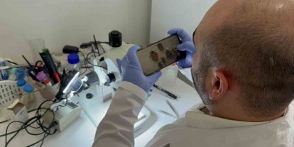 Tokat’ta uzmanından kene uyarısı: İklim düzensizliği ve küresel ısınma kene sezonunu uzatıyor