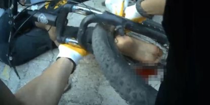 Osmaniye’de ayağı bisikletin tekerine sıkışan çocuk ekiplerce kurtarıldı