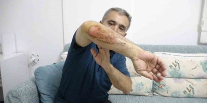 Otizmli oğluyla doğa gezisi sırasında sahipli köpeklerin saldırısına uğradı