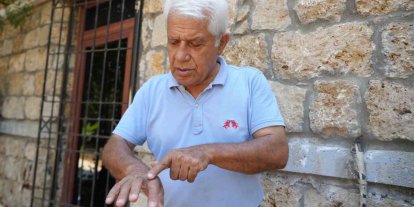 Su altında temizlik yaparken eline aslan balığı dikenleri batan profesörden sıcak sulu ilk müdahale uyarısı