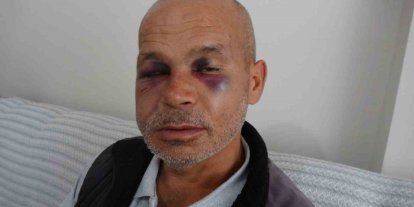 Engelli adamı darbeden şüpheli serbest bırakıldı