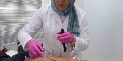 Dr. Esra Çetin Timur’dan hacamat uyarısı: "Bu uygulamayı hekim bizzat yapmalı"