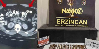 Erzincan’da uyuşturucuyu vücutlarında taşıyan 3 şüpheli yakalandı