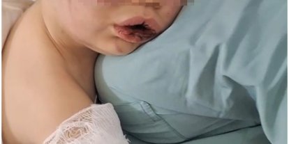 Darp sonucu hastanelik olan bebek devlet korumasına alınacak