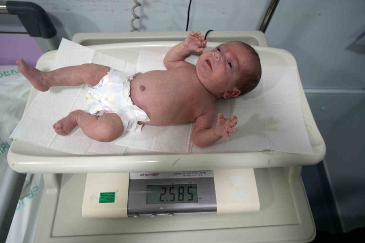 895 gram doğan Güneş bebek hayata tutundu